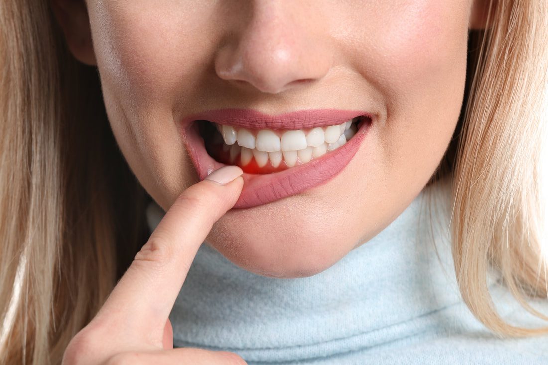 gum disease - bradenton, fl
